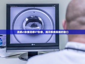 流感ct影像流感CT影像，揭示疾病真相的窗口