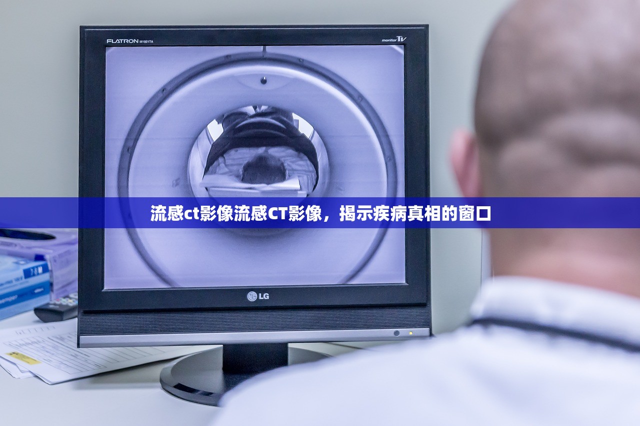 流感ct影像流感CT影像，揭示疾病真相的窗口  第1张